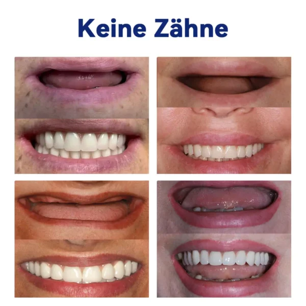 𝐇𝐄𝐀𝐓𝐖𝐎𝐋𝐅®-🦷𝐄𝐫𝐰𝐞𝐢𝐭𝐞𝐫𝐭𝐞𝐬 𝐢𝐧𝐝𝐢𝐯𝐢𝐝𝐮𝐞𝐥𝐥𝐞𝐬 𝐕𝐨𝐥𝐥𝐩𝐫𝐨𝐭𝐡𝐞𝐬𝐞𝐧-𝐒𝐞𝐭🦷 (🔥Begrenzter Zeitrabatt für die letzten 30 Minuten🔥)👑👑