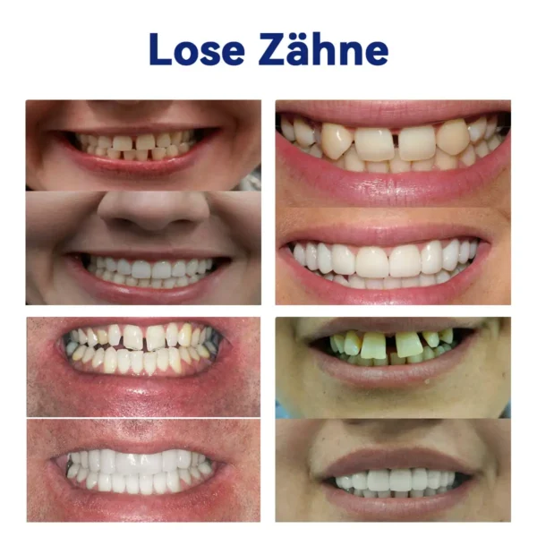 𝐇𝐄𝐀𝐓𝐖𝐎𝐋𝐅®-🦷𝐄𝐫𝐰𝐞𝐢𝐭𝐞𝐫𝐭𝐞𝐬 𝐢𝐧𝐝𝐢𝐯𝐢𝐝𝐮𝐞𝐥𝐥𝐞𝐬 𝐕𝐨𝐥𝐥𝐩𝐫𝐨𝐭𝐡𝐞𝐬𝐞𝐧-𝐒𝐞𝐭🦷 (🔥Begrenzter Zeitrabatt für die letzten 30 Minuten🔥)👑👑