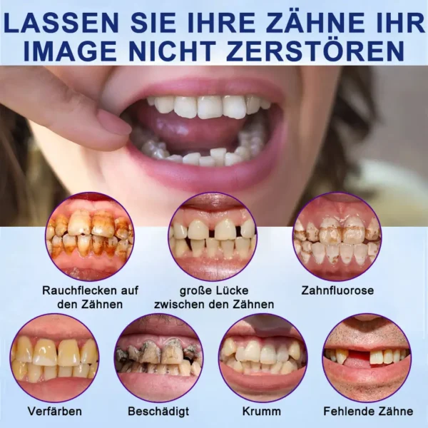 𝐇𝐄𝐀𝐓𝐖𝐎𝐋𝐅®-🦷𝐄𝐫𝐰𝐞𝐢𝐭𝐞𝐫𝐭𝐞𝐬 𝐢𝐧𝐝𝐢𝐯𝐢𝐝𝐮𝐞𝐥𝐥𝐞𝐬 𝐕𝐨𝐥𝐥𝐩𝐫𝐨𝐭𝐡𝐞𝐬𝐞𝐧-𝐒𝐞𝐭🦷 (🔥Begrenzter Zeitrabatt für die letzten 30 Minuten🔥)👑👑