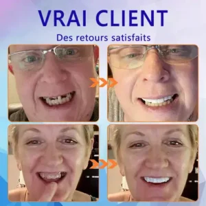 HEATWOLF® 🦷 Prothèse Dentaire Complète Sur Mesure Haut de Gamme 💎 (⏰Promotion limitée - Plus que 30 minutes !)