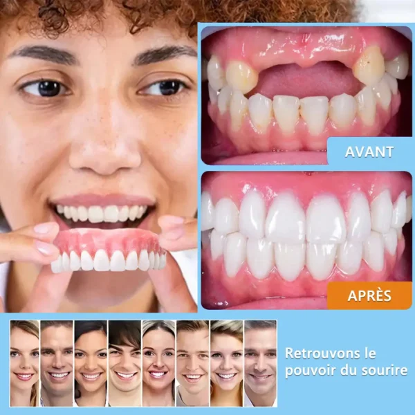 HEATWOLF® 🦷 Prothèse Dentaire Complète Sur Mesure Haut de Gamme 💎 (⏰Promotion limitée - Plus que 30 minutes !)