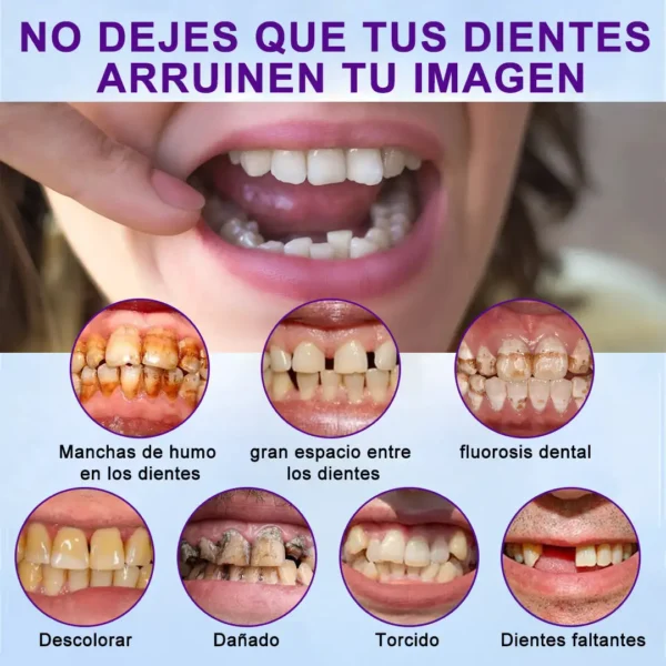 HEATWOLF™ - 🦷Kit avanzado de dentadura postiza completa personalizada🦷 (⏰Descuento por tiempo limitado, últimos 30 minutos⏰) ❤️