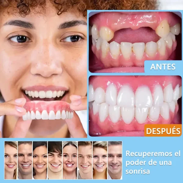 HEATWOLF™ - 🦷Kit avanzado de dentadura postiza completa personalizada🦷 (⏰Descuento por tiempo limitado, últimos 30 minutos⏰) ❤️