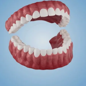 HEATWOLF® 🧡Premium Advanced Customized Full Denture Set 🧡 (⏰Limited time discount last 30 minutes)