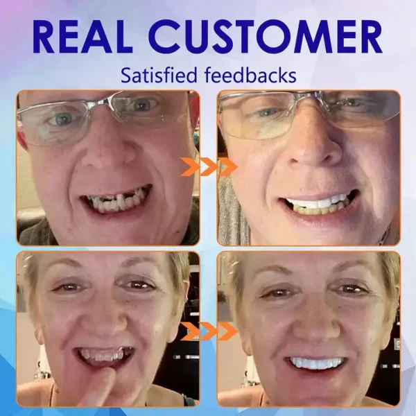 HEATWOLF® 🧡Premium Advanced Customized Full Denture Set 🧡 (⏰Limited time discount last 30 minutes)