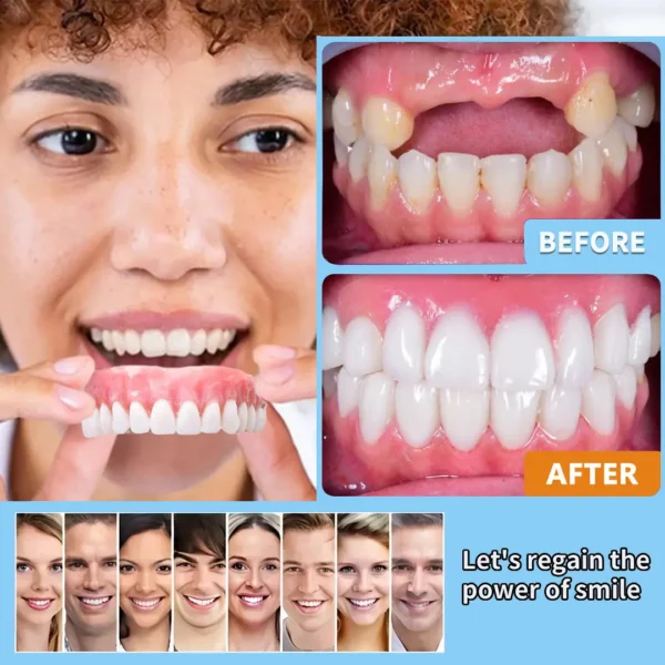 HEATWOLF® 🧡Premium Advanced Customized Full Denture Set 🧡 (⏰Limited time discount last 30 minutes)
