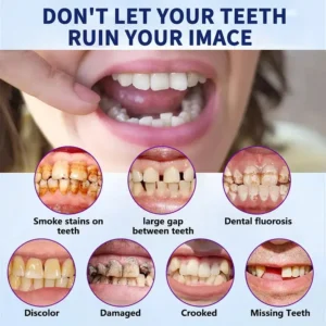 HEATWOLF® 🧡Premium Advanced Customized Full Denture Set 🧡 (⏰Limited time discount last 30 minutes)