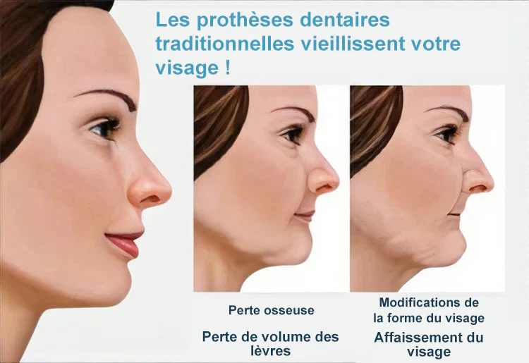 HEATWOLF® 🦷 Prothèse Dentaire Complète Sur Mesure Haut de Gamme 💎 (⏰Promotion limitée - Plus que 30 minutes !)
