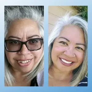 𝗠𝗲𝗱𝗶𝗰𝗮𝗹-𝗚𝗿𝗮𝗱𝗲 𝗙𝘂𝗻𝗰𝘁𝗶𝗼𝗻𝗮𝗹 𝗧𝗵𝗶𝗰𝗸𝗲𝗻𝗲𝗱 𝗗𝗲𝗻𝘁𝘂𝗿𝗲𝘀🗽𝗠𝗮𝗱𝗲 𝗜𝗻 𝗧𝗵𝗲 𝗨𝗦𝗔