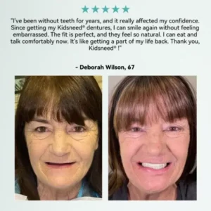 💎𝐊𝐢𝐝𝐬𝐧𝐞𝐞𝐝® 𝐇𝐲𝐝𝐫𝐨𝐒𝐡𝐚𝐩𝐞 𝐓𝐡𝐞𝐫𝐦𝐨-𝐀𝐝𝐚𝐩𝐭𝐢𝐯𝐞 𝐒𝐦𝐚𝐫𝐭 𝐅𝐮𝐥𝐥 𝐃𝐞𝐧𝐭𝐮𝐫🦷Not a Toy. This Is the Real Thing🦷