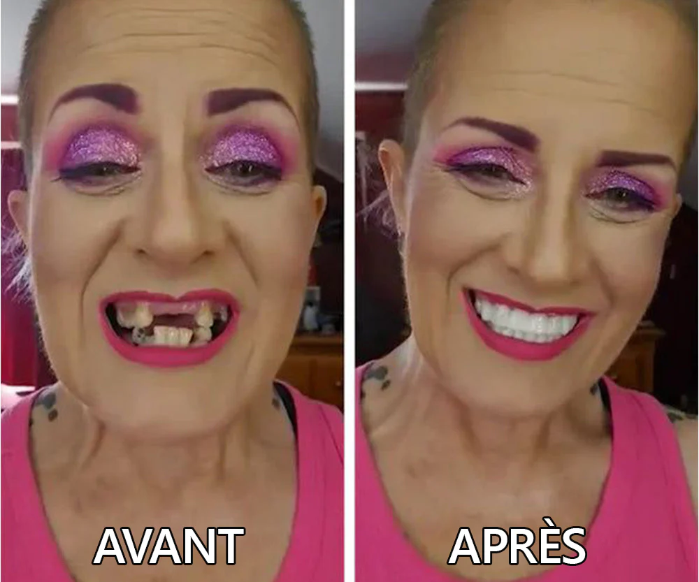Boutique Officielle | 🌟Ensemble Complet de Dentiers en Silicone HEATWOLF® 🧑🏼‍⚕️Recommandé par l’Association Dentaire Française (ADF)