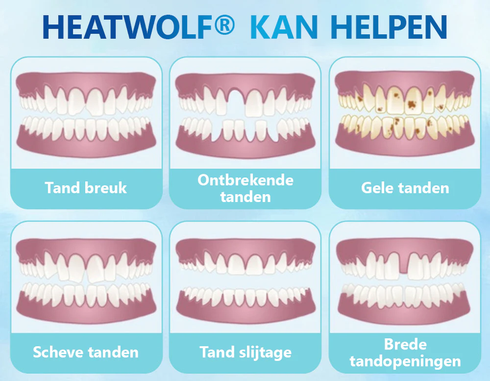 ✅Officiële Winkel | HEATWOLF® Siliconen Volledig Kunstgebit 🧑🏼‍⚕️Aanbevolen door de Belgische Tandartsenvereniging (VBT)