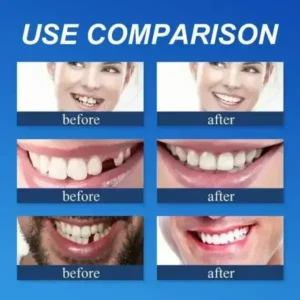 Clinclii™ –Advanced Customized Full Denture Set🦷
