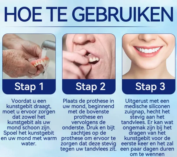 HEATWOLF™ Geavanceerde op maat gemaakte volledige protheseset🌸(Officieel aanbevolen product door de Belgische Tandartsenvereniging (BDA))🎁