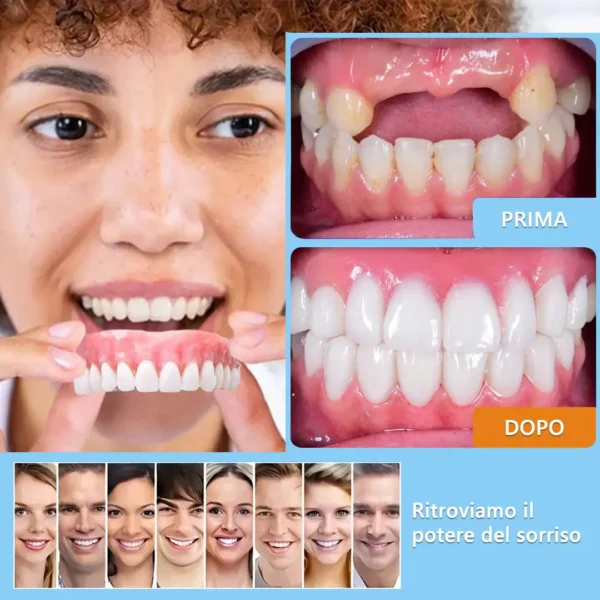 HEATWOLF® 🧡Set Completo di Protesi Dentaria Personalizzata Premium Avanzata 🧡 (⏰Sconto a tempo limitato, ultimi 30 minuti)