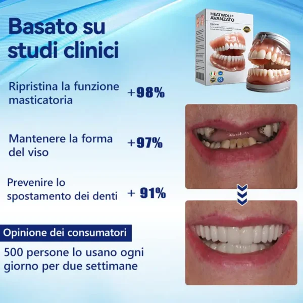 HEATWOLF® 🧡Set Completo di Protesi Dentaria Personalizzata Premium Avanzata 🧡 (⏰Sconto a tempo limitato, ultimi 30 minuti)