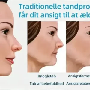 Hidone® Fuldt tandproteser Sæt 🦷🦷💃Avancerede selvjusterende tandlæge Materialer (⏰Begrænset tidsrabat sidste 30 minutter⏰)