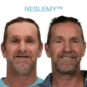 NESLEMY™ GelFit Dentures – Made in the USA & FDA-Certified