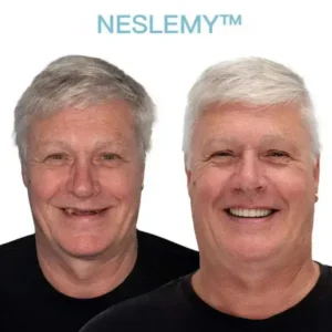 NESLEMY™ GelFit Dentures – Made in the USA & FDA-Certified