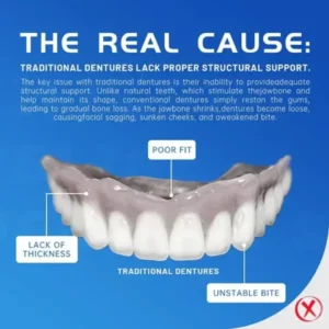 BQYOOM™-🦷Advanced Customized Full Denture Set🦷