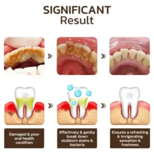 SmileFitPro™ Niacinamide Whitening Toothpaste
