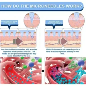 PEAKA® GLP-1 & NAD+ Slimming & health NANO MICRONEEDLE PATCH