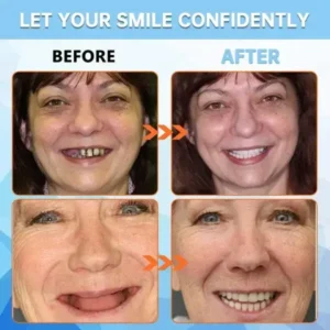 ROSOPL™ Adsorptive Dentures