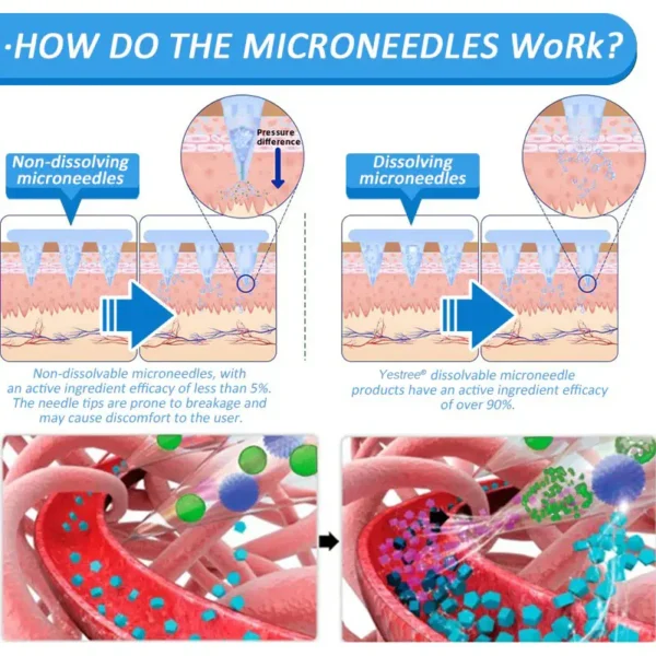 Yestree®👨‍⚕️ Nano Microneedle Patch with SMGT-GLP-1 & Matrixyl 3000 – Slimming, Skin Tightening, Blood Sugar Support, No Injection, 7-Day Result