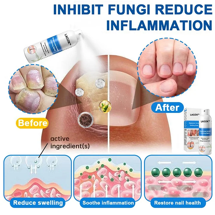 LAOZIK™ Magnesium Herbal Spray