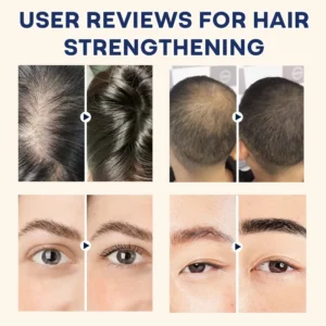 AAFQ®Natural Castor Oil Roll-On| 100% Pure, Unscented, For Radiant Skin | Deeply Hydrates | Reduces Fine Lines | Lush Hair & Relaxation