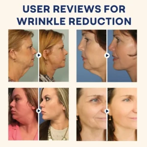 AAFQ®Natural Castor Oil Roll-On| 100% Pure, Unscented, For Radiant Skin | Deeply Hydrates | Reduces Fine Lines | Lush Hair & Relaxation