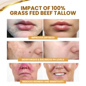 Cvreoz® DermSerene Beef Tallow Honey Balm