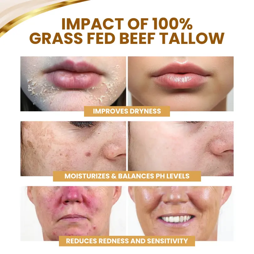 Cvreoz® DermSerene Beef Tallow Honey Balm