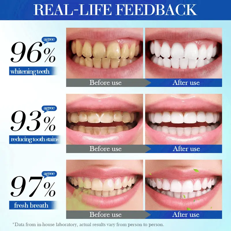 š„Hot Listing š„ AQA⢠Hydroxyapatite Toothpaste 7.5% for Enamel Repair & Teeth Whitening Refreshing Flavor Fluorid