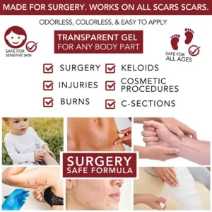 LAOZIK™ Medical-Grade Silicone Scar Gel