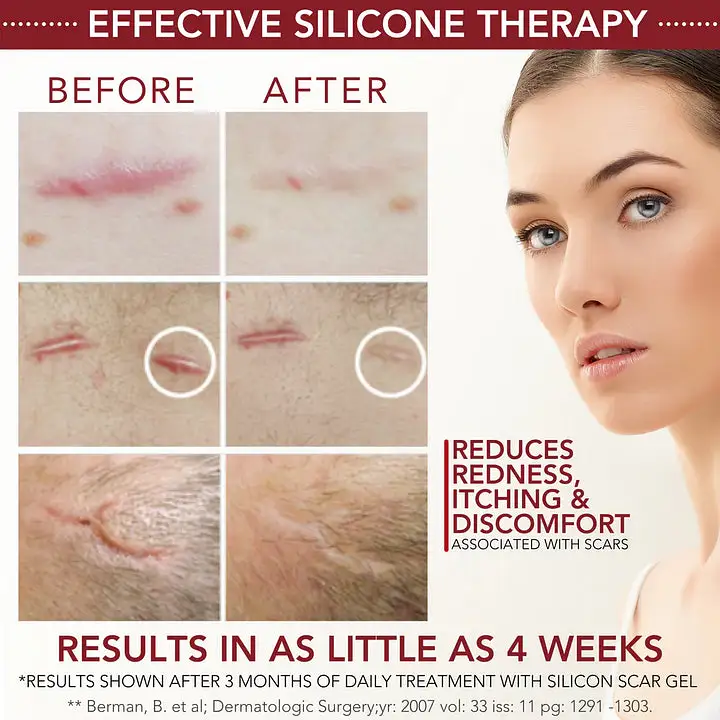 LAOZIK™ Medical-Grade Silicone Scar Gel