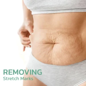 LOVILDS™ CollagenPlus Matrixyl Synthe'6 Lifting Body Oil