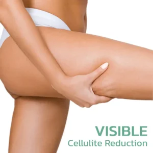 LOVILDS™ CollagenPlus Matrixyl Synthe'6 Lifting Body Oil