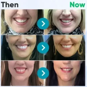 🇬🇧👨🏼⚕️Rolimey® VioGloss Bee Venom Dental Therapy Oral Power🦷