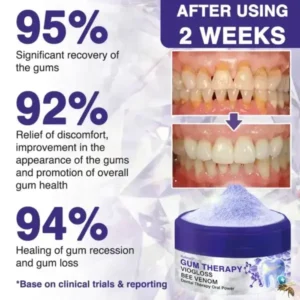 🇬🇧👨🏼⚕️Rolimey® VioGloss Bee Venom Dental Therapy Oral Power🦷