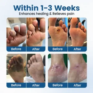 TAILEDEN® AngioVita Diabetic Care Spray