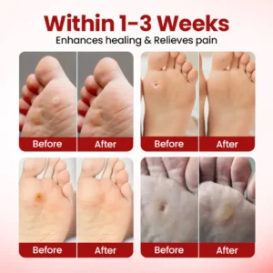 TAILEDEN™ Foot Care Gel