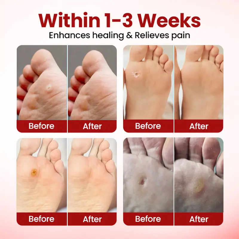 TAILEDEN™ Foot Care Gel