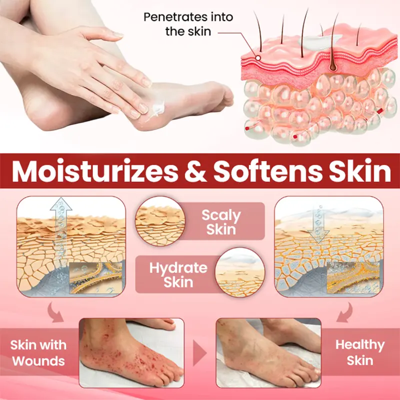 TAILEDEN™ Foot Care Gel