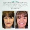Advanced Custom-Fit Functional Dentures 🦷 Smile Confidently Again in Just 3 Minutes No Dentist Needed!