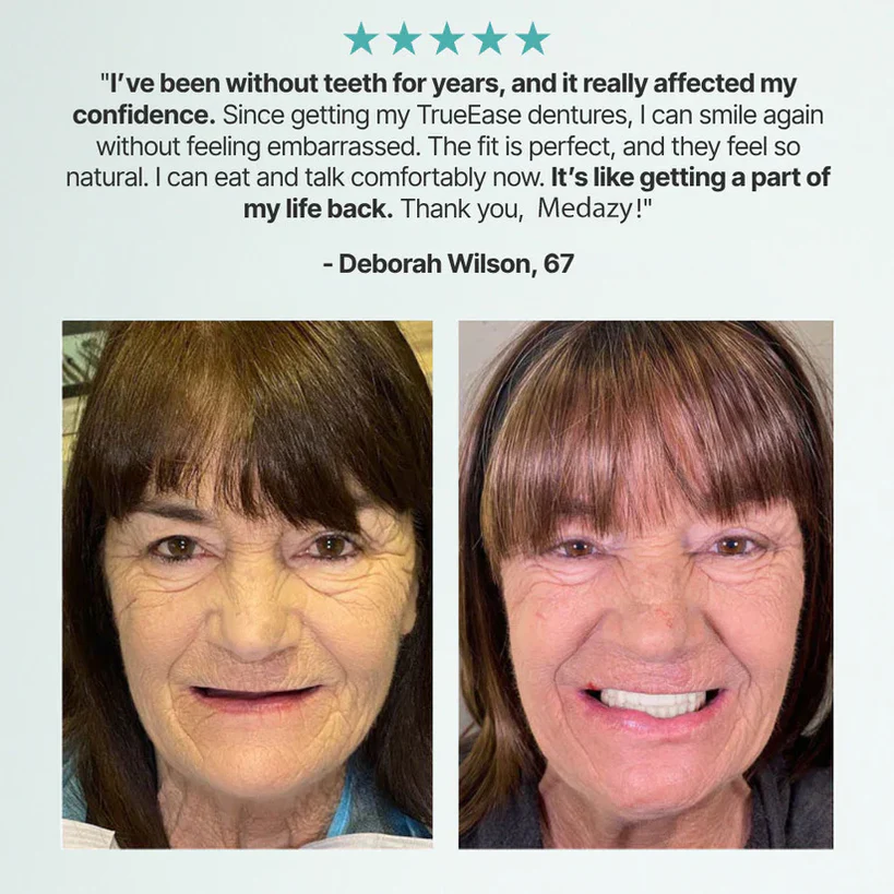 Advanced Custom-Fit Functional Dentures 🦷 Smile Confidently Again in Just 3 Minutes No Dentist Needed!