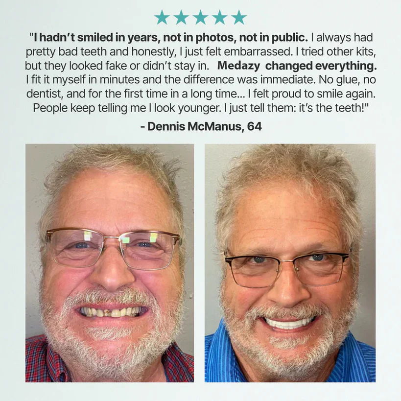 Advanced Custom-Fit Functional Dentures 🦷 Smile Confidently Again in Just 3 Minutes No Dentist Needed!