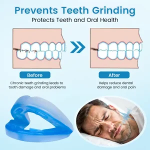 QIAWI™ Sleep & Relax Breathing Protector – Dentist-Designed