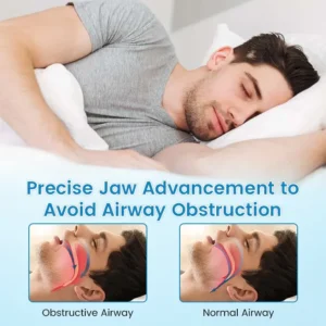 QIAWI™ Sleep & Relax Breathing Protector – Dentist-Designed