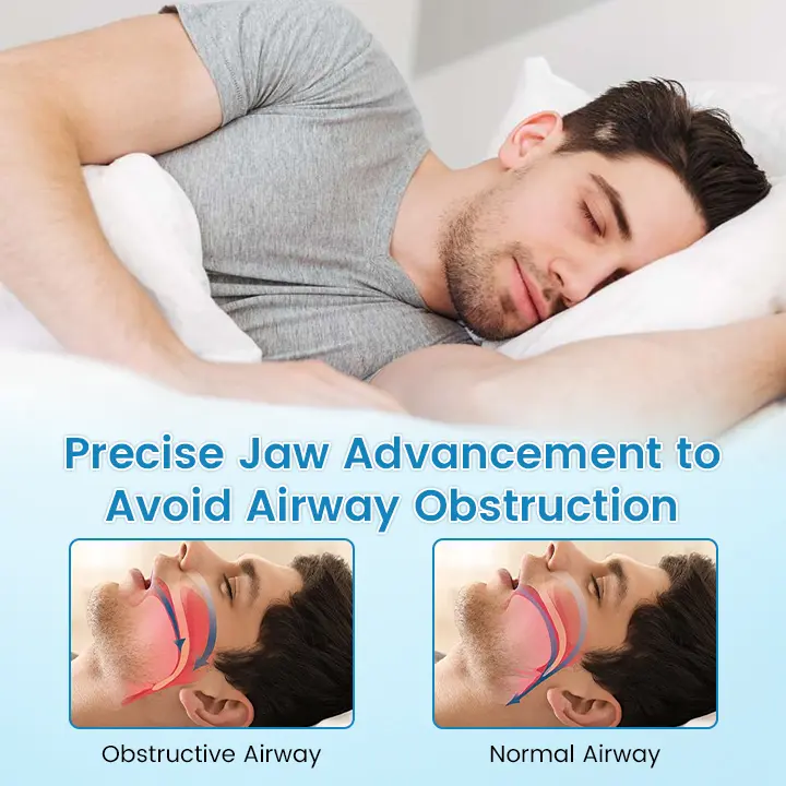 QIAWI™ Sleep & Relax Breathing Protector – Dentist-Designed
